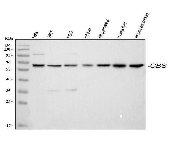 Anti-Cystathionine beta-synthase CBS Antibody Picoband® Boster Bio