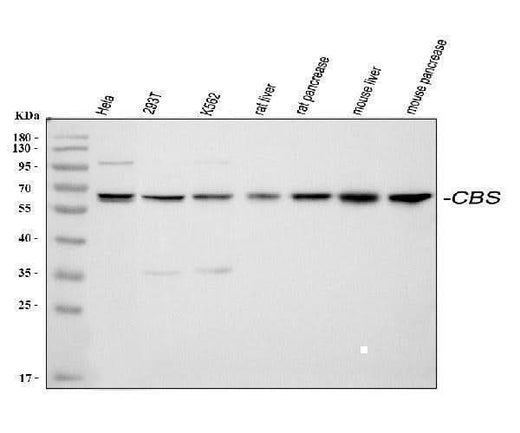 Anti-Cystathionine beta-synthase CBS Antibody Picoband® Boster Bio