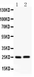 Anti-Claudin 2/CLDN2 Antibody Picoband® Boster Bio