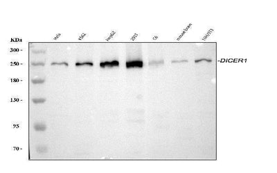 Anti-Dicer/DICER1 Antibody Picoband® Boster Bio