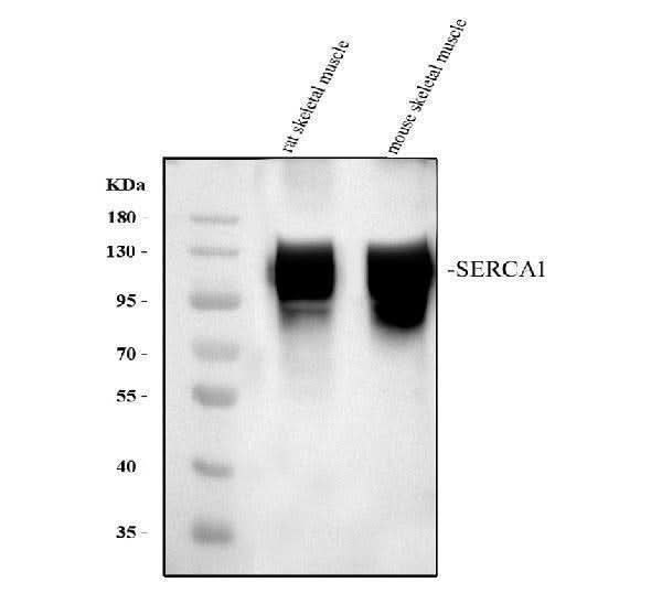 Anti-SERCA1 ATPase/ATP2A1 Antibody Picoband® Boster Bio