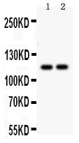 Anti-SERCA3 ATPase/ATP2A3 Antibody Picoband® Boster Bio