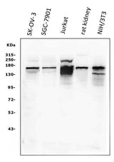 Anti-KAT13A/SRC1/NCOA1 Antibody Picoband® Boster Bio