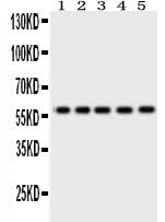 Anti-Occludin/OCLN Antibody Picoband® Boster Bio