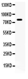 Anti-FE65/APBB1 Antibody Picoband® Boster Bio