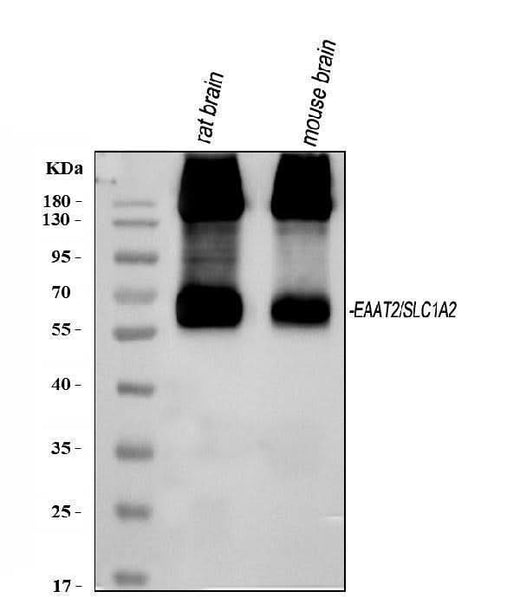 Anti-EAAT2/GLT-1/SLC1A2 Antibody Picoband® Boster Bio