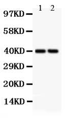 Anti-SFRP4 Antibody Picoband® Boster Bio