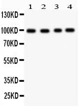 Anti-Synaptopodin/SYNPO Antibody Picoband® Boster Bio