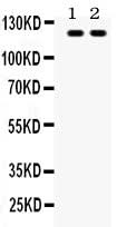Anti-Toll-like receptor 8 TLR8 Antibody Picoband® Boster Bio