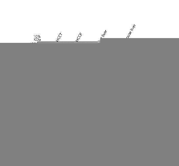 Anti-liver Arginase/ARG1 Antibody Picoband® Boster Bio