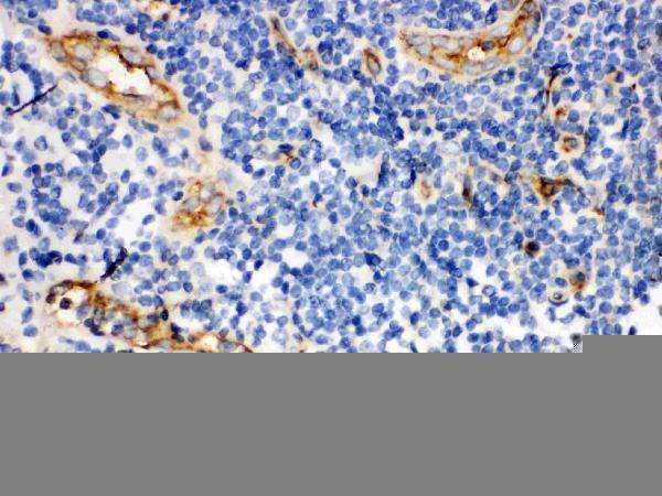 Anti-CD59 glycoprotein CD59 Antibody Picoband® Boster Bio