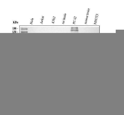 Anti-TSG101 Antibody Picoband® Boster Bio