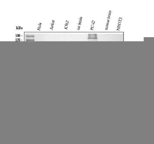 Anti-TSG101 Antibody Picoband® Boster Bio