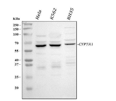 Anti-CYP7A1 Antibody Picoband® Boster Bio