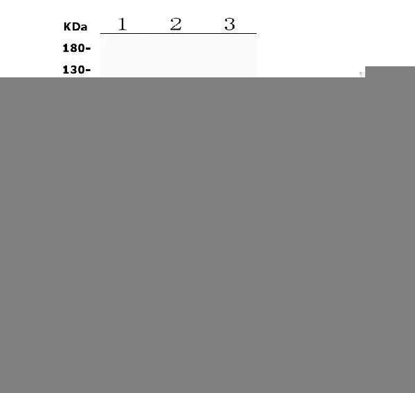 Anti-Osteopontin/SPP1 Antibody Picoband® Boster Bio