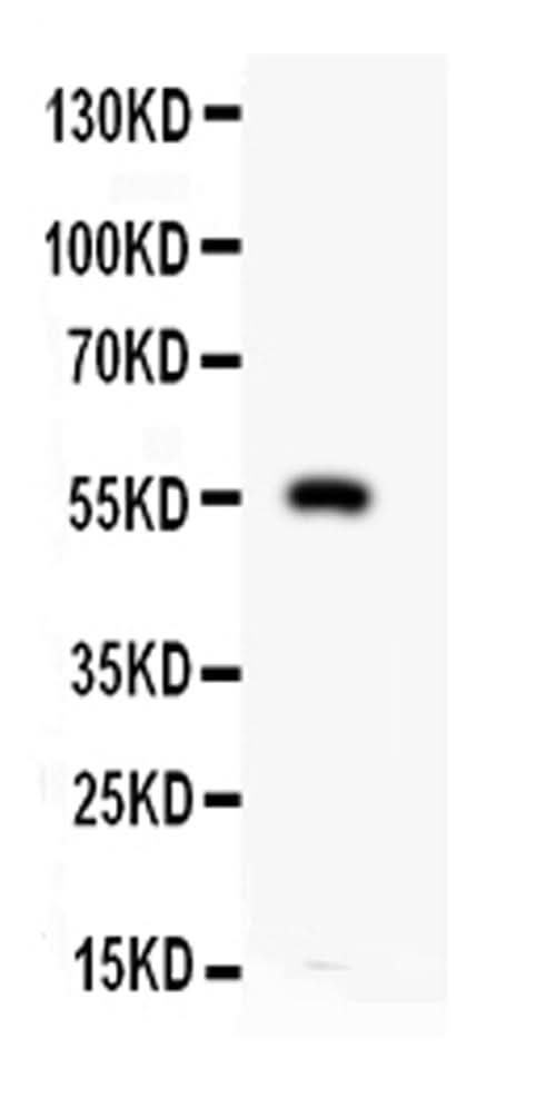 Anti-Macrophage metalloelastase MMP12 Antibody Picoband® Boster Bio