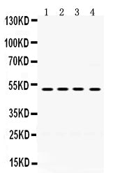 Anti-TIM 1/HAVCR1 Antibody Picoband® Boster Bio