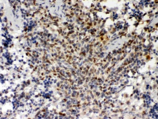 Anti-PU.1/Spi1 Antibody Boster Bio