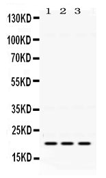 Anti-GTPase HRAS Antibody Picoband® Boster Bio