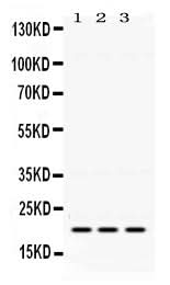 Anti-GTPase HRAS Antibody Picoband® Boster Bio