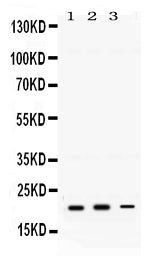 Anti-GTPase HRAS Antibody Picoband® Boster Bio