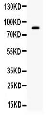 Anti-SMURF 2/SMURF2 Antibody Picoband® Boster Bio