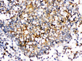 Anti-CD153/TNFSF8 Antibody Boster Bio