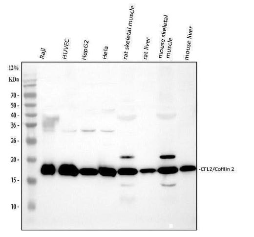 Anti-Cofilin 2/CFL2 Antibody Picoband® Boster Bio