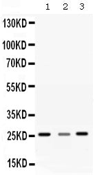 Anti-SR1/SRI Antibody Picoband® Boster Bio
