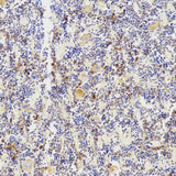 Immunohistochemistry analysis of paraffin-embedded mouse bone using TNFRSF11B Polyclonal Antibody at dilution of 1:200.