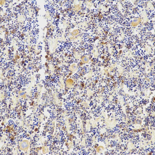 Immunohistochemistry analysis of paraffin-embedded mouse bone using TNFRSF11B Polyclonal Antibody at dilution of 1:200.