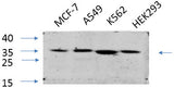 Western Blot analysis of various cells using EIF2 alpha Polyclonal Antibody at dilution of 1:1000.