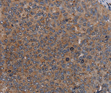Anti-Human LIPE Antibody - ABMIUM