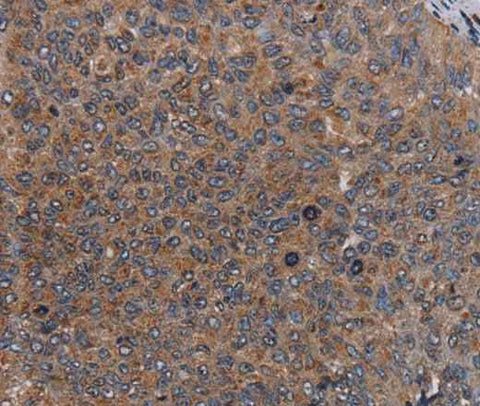 Anti-Human LIPE Antibody