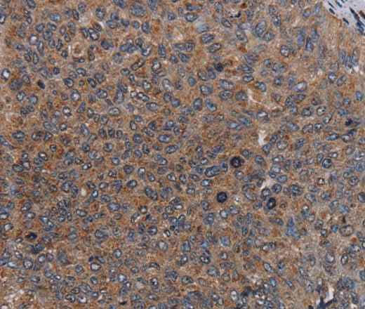 Anti-Human LIPE Antibody