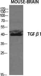 Anti-Human/Mouse/Rat TGFB1 Antibody