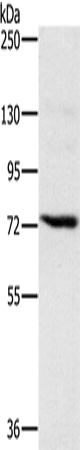 Anti-Human/Mouse/Rat NCSTN Antibody - ABMIUM