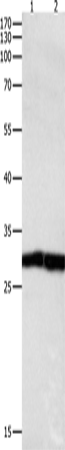Anti-Human/Mouse/Rat DUSP6 Antibody - ABMIUM