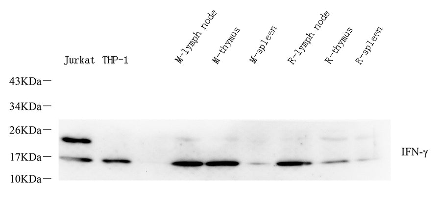 Western Blot analysis of various samples using IFNG Polyclonal Antibody at dilution of 1:400.