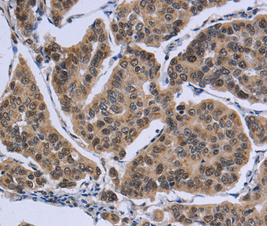 Anti-Human/Mouse IPO8 Antibody - ABMIUM