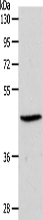 Anti-Human/Mouse S1PR3 Antibody - ABMIUM