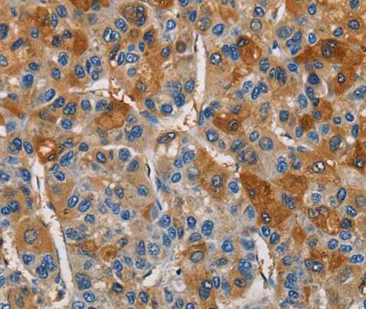 Anti-Human CST4 Antibody