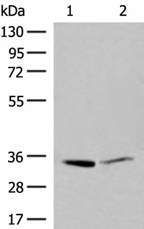 Western blot analysis of A375 and Hela cell lysates using LDHA Polyclonal Antibody at dilution of 1:400