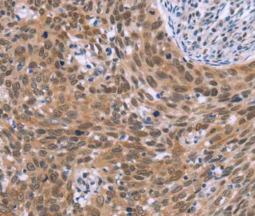 Anti-Human/Mouse/Rat GLYR1 Antibody