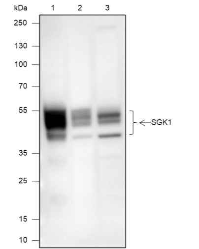 Anti-Human SGK1 Antibody [A670]