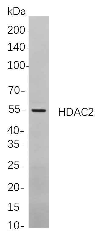 Anti-Human/Mouse/Rat HDAC2 Antibody [B834] - ABMIUM
