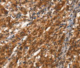 Anti-Human CYP2D6 Antibody - ABMIUM