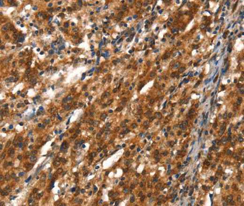 Anti-Human CYP2D6 Antibody