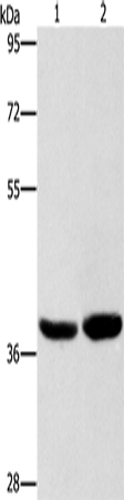 Anti-Human/Mouse CAB39L Antibody - ABMIUM