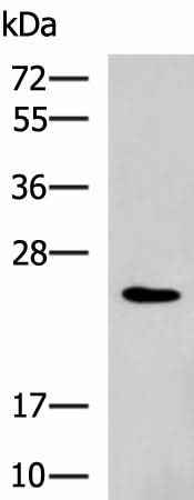 Anti-Human/Mouse RAB38 Antibody